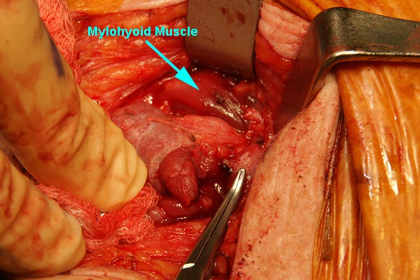 9.  Mylohoid Muscle