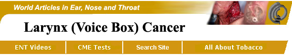 Larynx (Voice Box) Cancer Video, Vocal Cord Cancer, Kevin Kavanagh